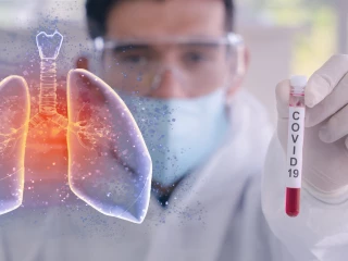 Diagnoza_Covid _9
