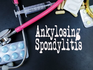 ankylozující spondylitida