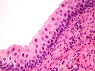urothelium GAG layer