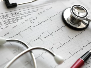 cardiovascular disease arthritis