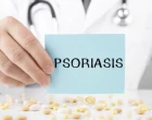 psoriasis ruka a leky