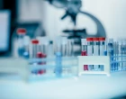 zkumavky clinical trial 25