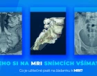 virtuální MRI trénink pozvánka