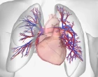 Plicní hypertenze – syndrom mnoha tváří – vyžaduje přesnou diagnostiku a specializovanou léčbu