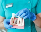 zubní implantáty