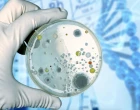 bacteria