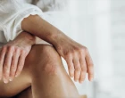 psoriasis