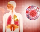 viral and bacterial pneumonia