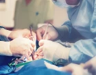 chirurgie
