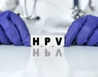 hpv obrazocek