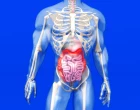 ulcerative colitis