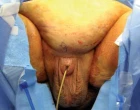zanoreny_penis