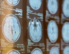 MRI magnetická rezonance zobrazovací metody 25