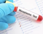 mycoplasma test