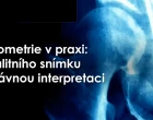 Denzitometrie v praxi: od kvalitního snímku po správnou interpretaci