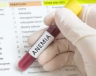 Anemia therapy