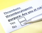 trombocytopenická purpura