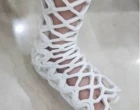 Noha fixace
