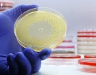 antibiotika resistence