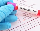 B12