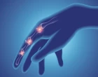rheumatoid arthritic disease