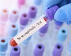 imunoglobulinem G (IgG)