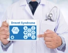 syndrom dravetové