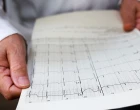 ECG reading 2025