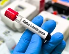 alfa-1-antitrypsin