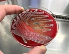 agar plate, petriho miska 25