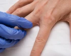 autoinflammatory diseases