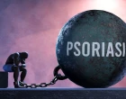 Psoriáza