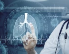 Karcinom plic screening