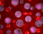 nonhodgkin lymphoma 25