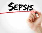 sepse
