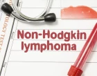 Hodgkinovu lymfomu