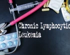 CLL