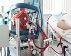 ECMO