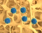 CAR T cell terapie Osteporozy