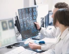 NeOKRádejte se o čas: 7 důvodů, proč v terapii RS zvolit subkutánní okrelizumab
