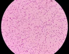 Stabilní citlivost E. coli a E. faecalis k nitrofurantoinu − srovnání regionálních antibiogramů