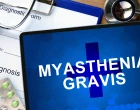 myastevia gravis