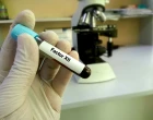 Blood sample for Factor XII