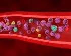 lipoprotein