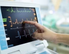 EKG monitor amyloid
