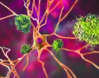 amyloid