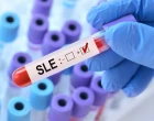 SLE