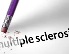 multiple sclerosis