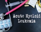 akutní myeloidní leukemie