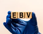 EBV